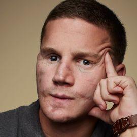 Kyle Carpenter